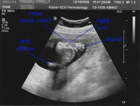 16 weeks, 6 days: waving