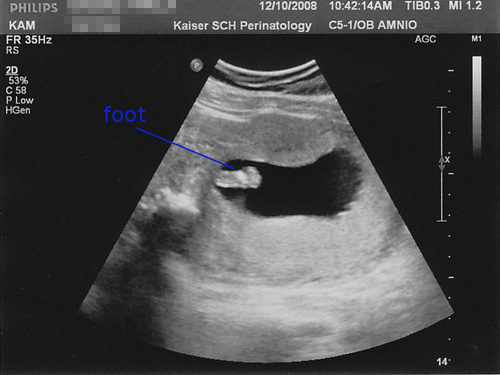 16 weeks, 6 days: foot