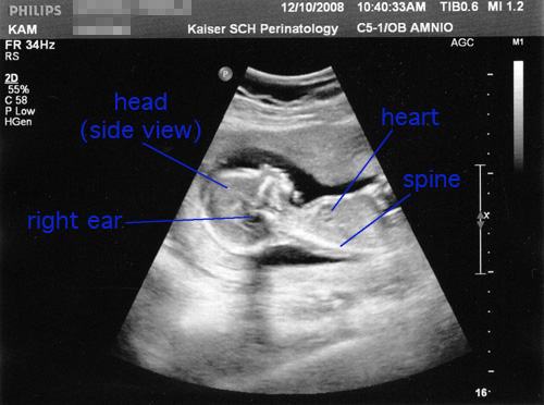 16 weeks, 6 days: side view