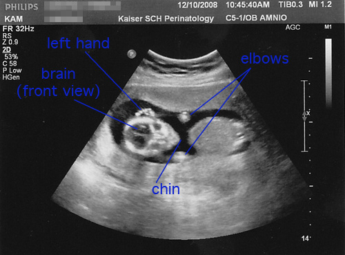 16 weeks, 6 days: front view